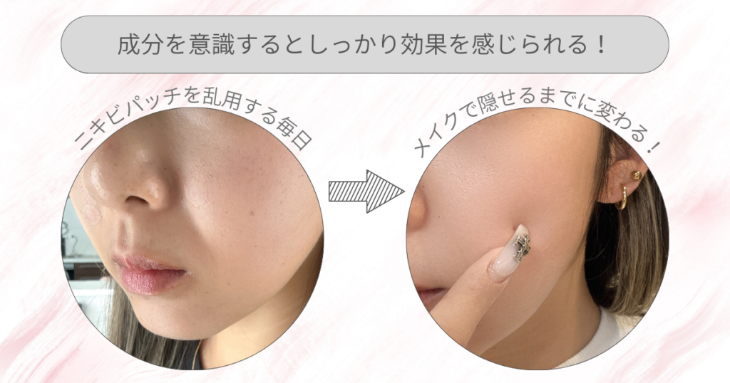 肌悩み別に選ぶ美容成分｜美容成分を意識すること