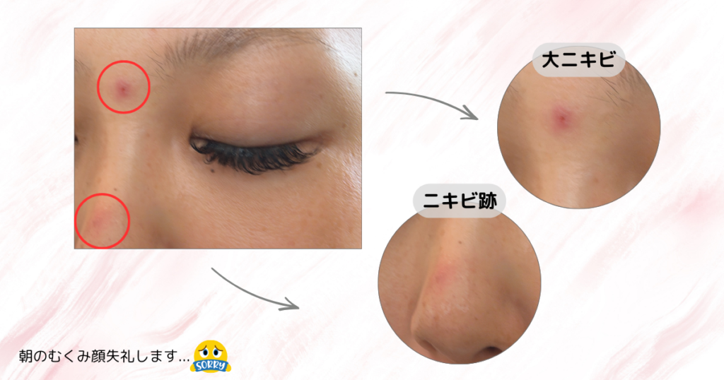 マジックティーツリーオイル検証｜検証前