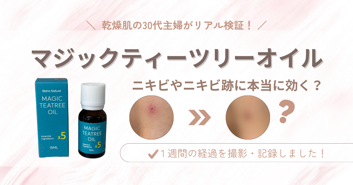【検証】マジックティーツリーオイル｜ニキビやニキビ跡に効くって本当？30代乾燥肌が1週間使ってみた！